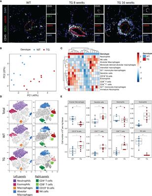 Fra-2 Is a Dominant Negative Regulator of Natural Killer Cell Development